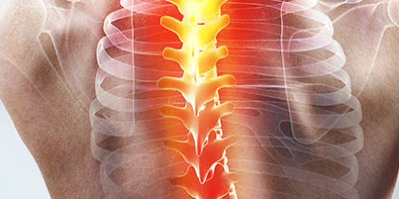 operacyjne-leczenie-skolioz-juz-w-ofercie-szpitala-na-klinach