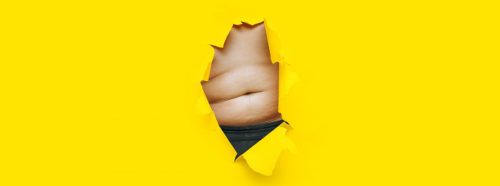 otylosc-olbrzymia-leczenie-i-dieta