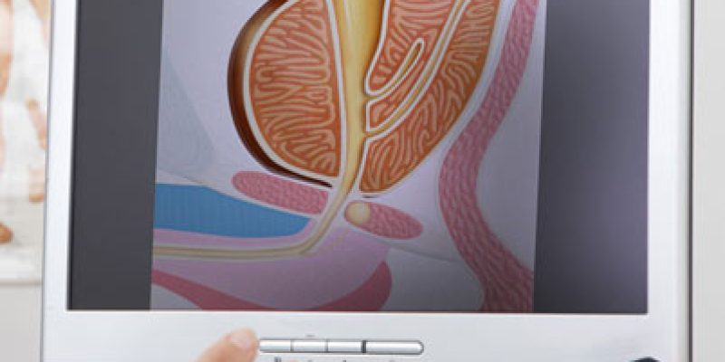 pacjenci-z-poludnia-polski-moga-juz-skorzystac-z-enukelacji-prostaty-holep pacjenci-z-poludnia-polski-moga-juz-skorzystac-z-enukelacji-prostaty-holep