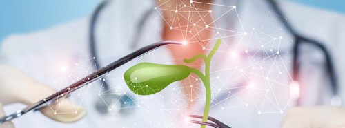 pecherzyk-zolciowy-objawy-chorob-diagnostyka-leczenie