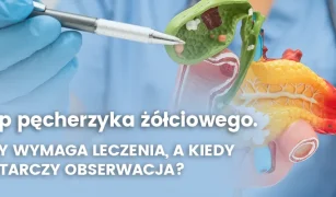 polip-pecherzyka-zolciowego