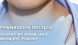 powiekszona-tarczyca