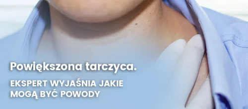 powiekszona-tarczyca