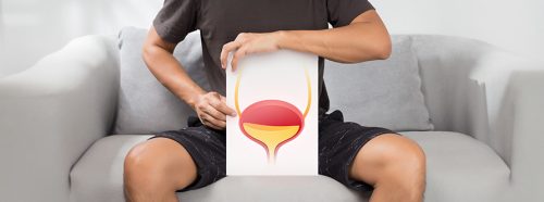 przyczyny-nietrzymania-moczu-u-mezczyzn-1