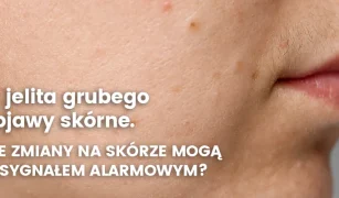 rak-jelita-a-objawy-skorne