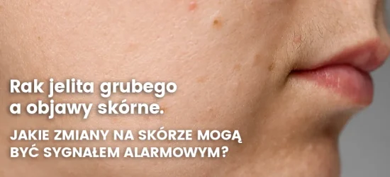 rak-jelita-a-objawy-skorne