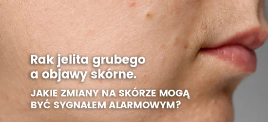 rak-jelita-grubego-a-objawy-skorne