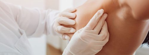 rak-piersi-najczestszy-nowotwor-u-kobiet