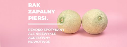 rak-zapalny-piersi-rzadko-spotykany-ale-niezwykle-agresywny-nowotwor-1