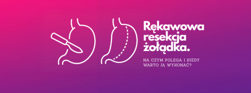rekawowa-resekcja-zoladka-na-czym-polega-i-kiedy-warto-ja-wykonac-1