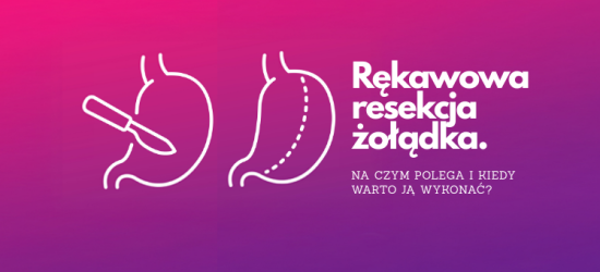 rekawowa-resekcja-zoladka-na-czym-polega-i-kiedy-warto-ja-wykonac-1