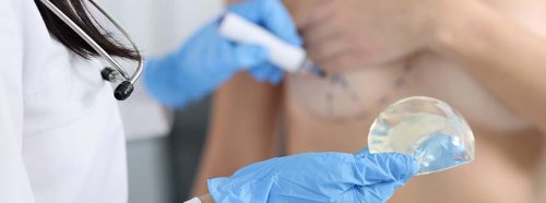 rekonstrukcja-piersi-po-mastektomii-amputacji-piersi