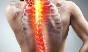 skolioza-kregoslupa-objawy-profilaktyka-leczenie-diagnostyka