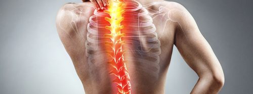 skolioza-kregoslupa-objawy-profilaktyka-leczenie-diagnostyka