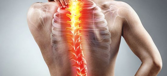 skolioza-kregoslupa-objawy-profilaktyka-leczenie-diagnostyka