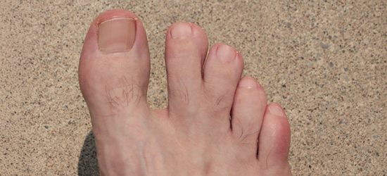 syndaktylia-palcozrost-skad-sie-bierze-i-jak-sie-leczy-1