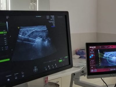 szpital-na-klinach-w-czolowce-polskich-osrodkow-specjalizujacych-sie-w-leczeniu-lagodnych-guzkow-tarczycy-z-wykorzystaniem-echolasera