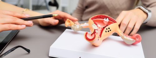 sztuczna-menopauza-ratunek-czy-wyzwanie-dla-kobiecego-organizmu-1