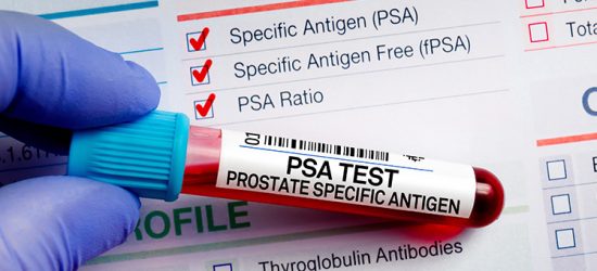 test-psa-proste-badanie-wielkie-znaczenie-co-powinienes-wiedziec-o-kluczowym-badaniu-w-diagnostyce-schorzen-prostaty-1
