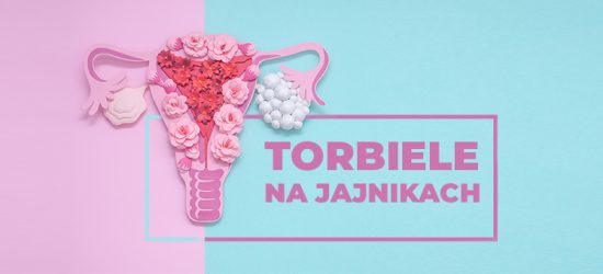 torbiele-na-jajnikach-1
