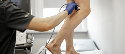 usg-doppler-w-diagnostyce-lipodemii