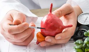 usuniecie-zylakow-ponowotwor-pecherza-moczowego-objawy-diagnostyka-leczeniewrozka-nasiennego-metoda-laparoskopowa-i-mikrochirurgiczna