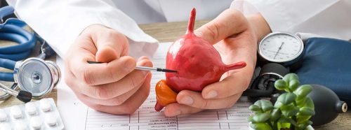 usuniecie-zylakow-ponowotwor-pecherza-moczowego-objawy-diagnostyka-leczeniewrozka-nasiennego-metoda-laparoskopowa-i-mikrochirurgiczna