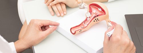 wypadanie-macicy-objawy-przyczyny-leczenie-1