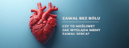 zawal-bez-bolu-1