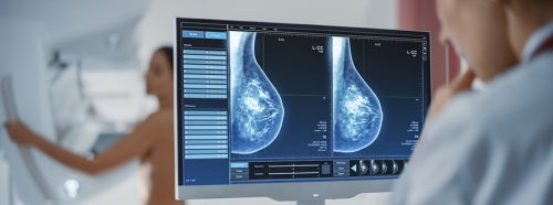 zrazikowy-rak-piersi-objawy-diagnozowanie-leczenie-1