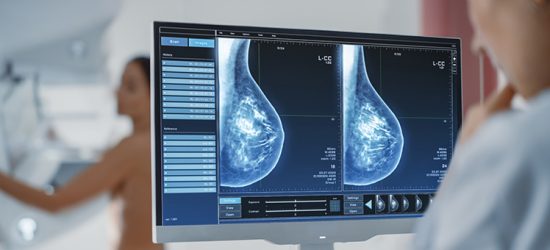 zrazikowy-rak-piersi-objawy-diagnozowanie-leczenie-1