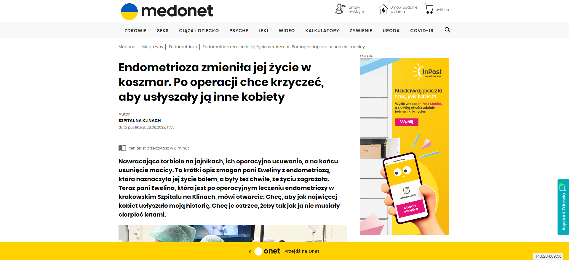 endometrioza zmienila jej zycie w koszmar po operacji chce krzyczec aby uslyszaly ja inne kobiety