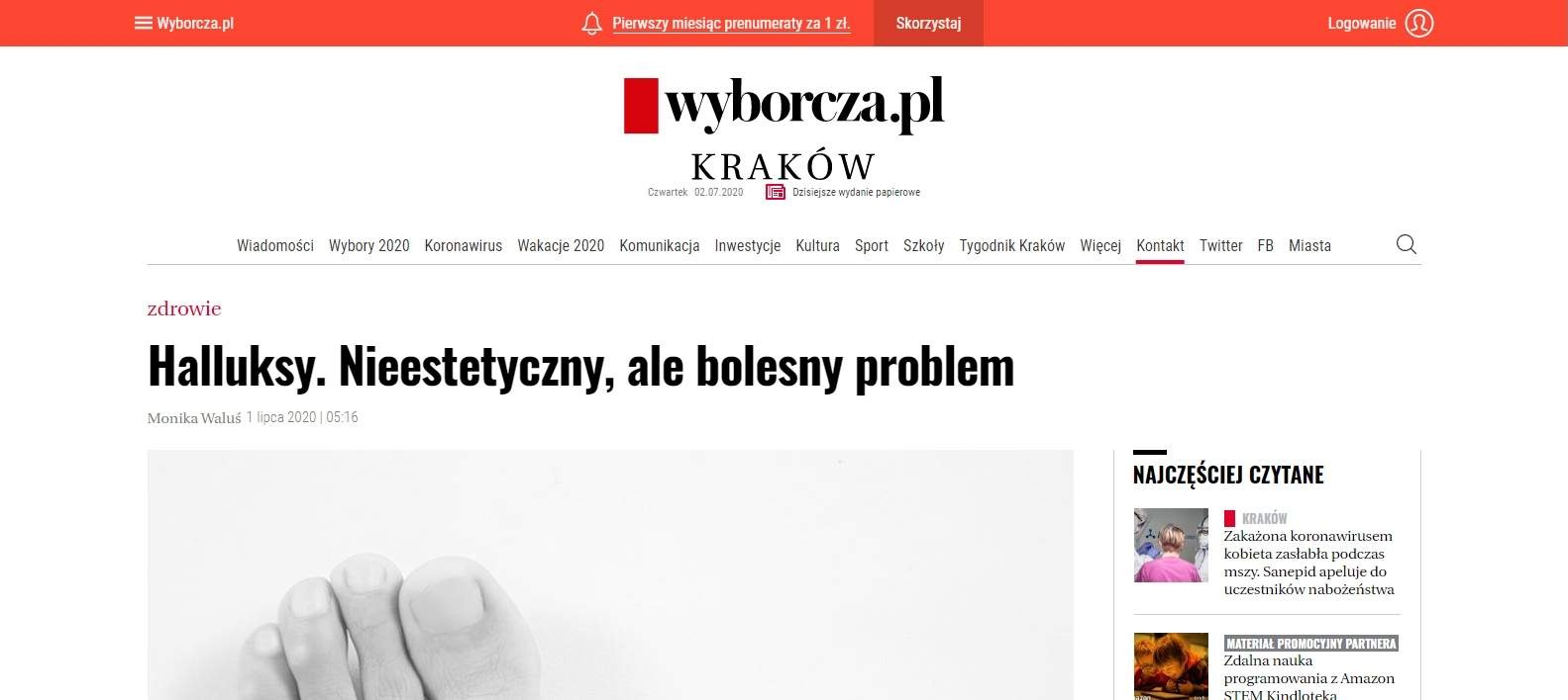 halluksy nieestetyczny ale bolesny problem