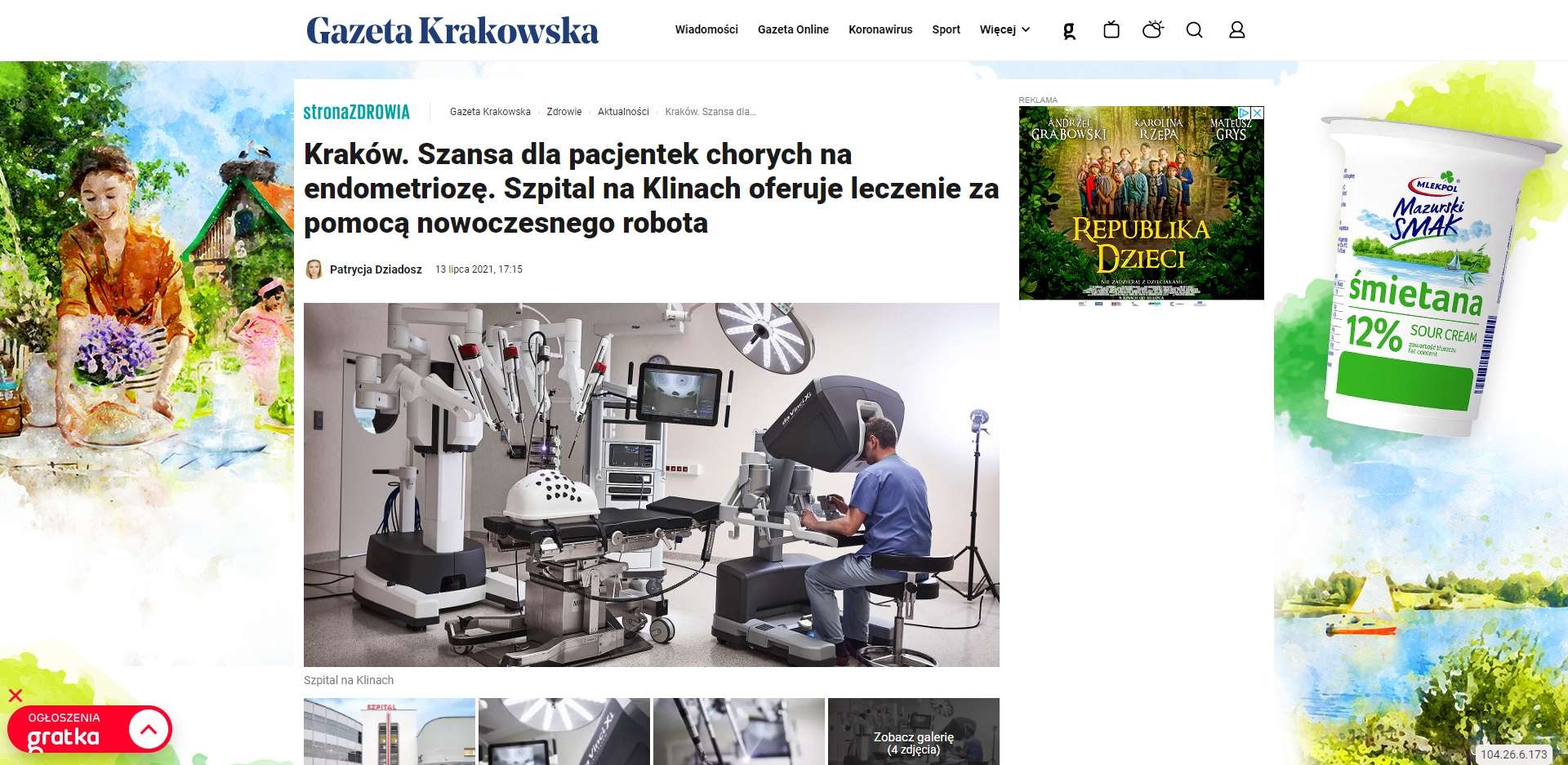 krakow szansa dla pacjentek chorych na endometrioze szpital na klinach oferuje leczenie za pomoca nowoczesnego robota