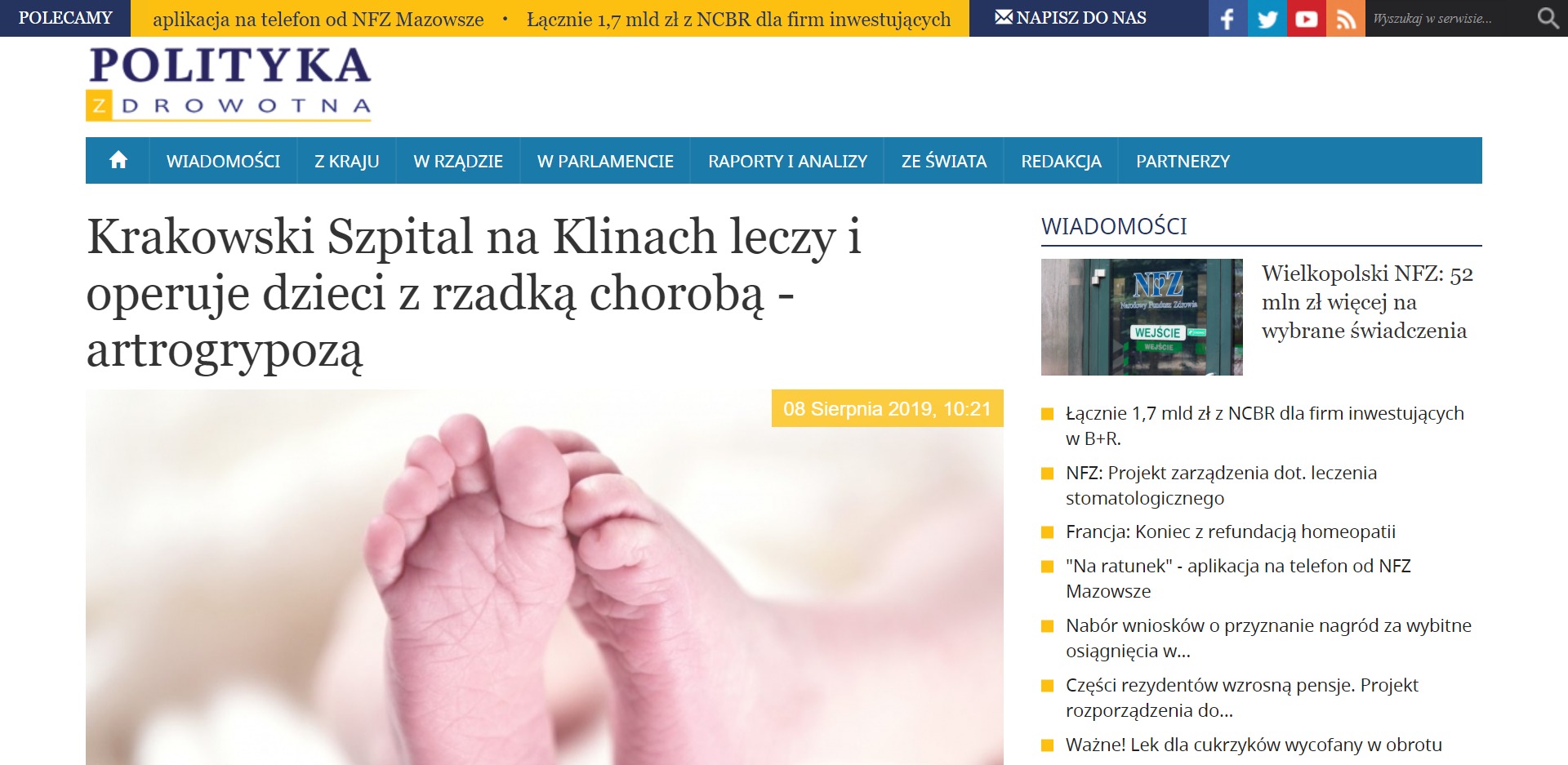 Krakowski Szpital na Klinach leczy i operuje dzieci z rzadką chorobą - artrogrypozą