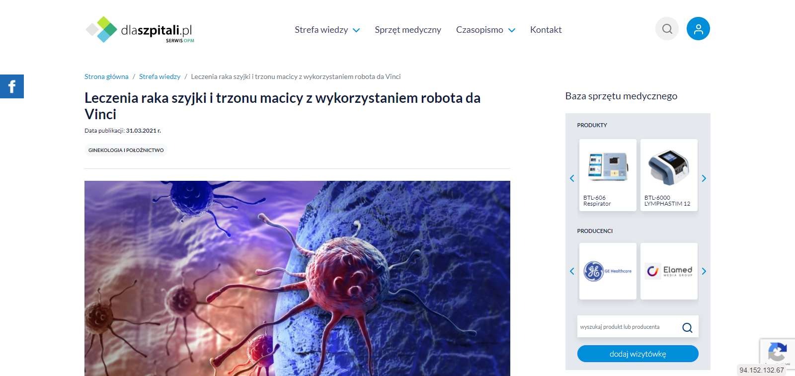 leczenia raka szyjki i trzonu macicy z wykorzystaniem robota da vinci