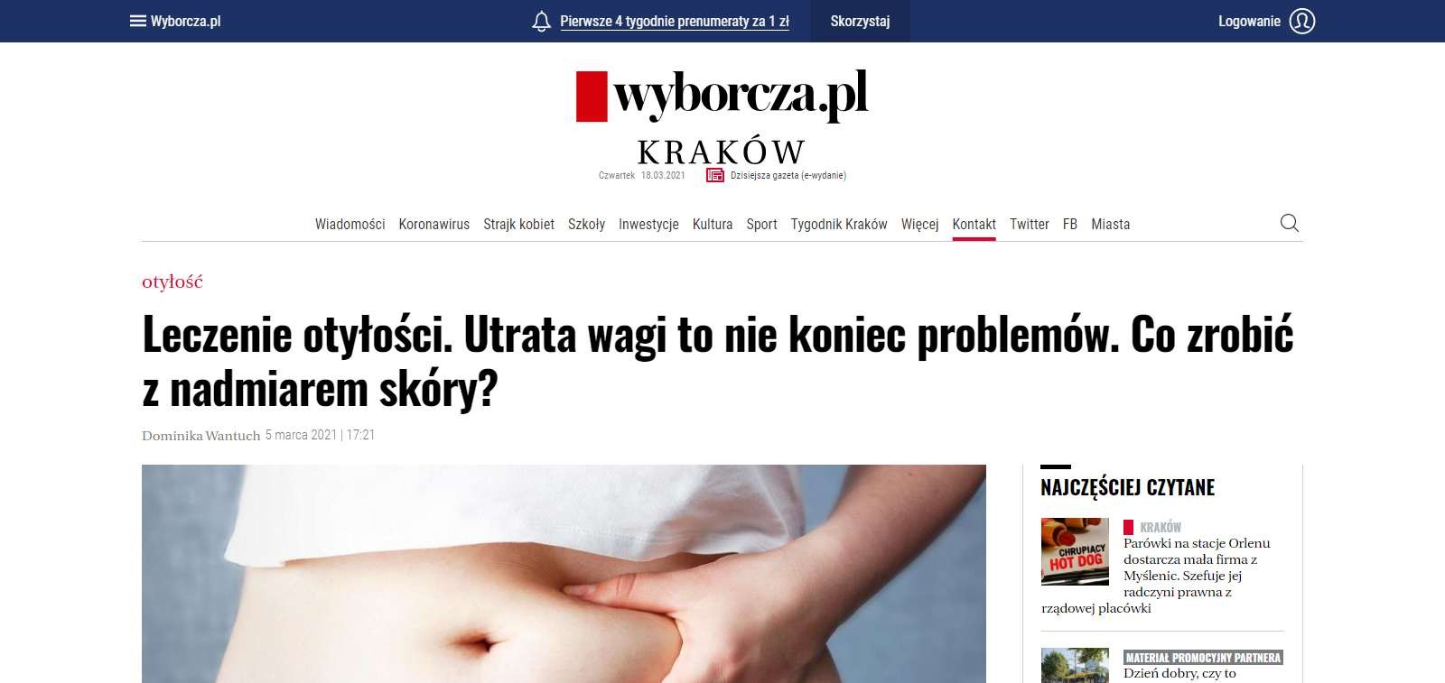 leczenie otylosci utrata wagi to nie koniec problemow co zrobic z nadmiarem skory