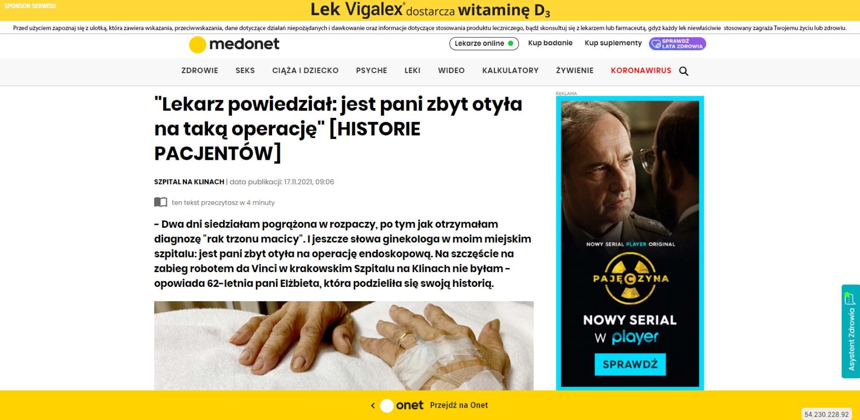 lekarz powiedzial jest pani zbyt otyla na taka operacje