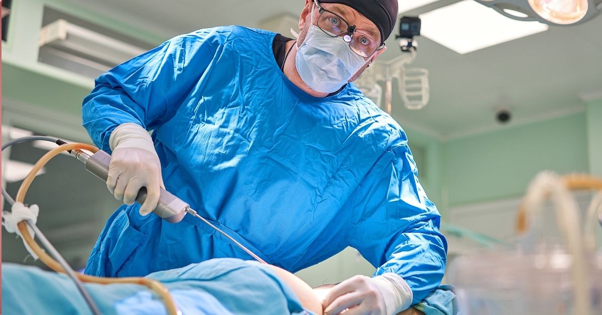 Nie schudniesz na stole operacyjnym. Prawda o liposukcji.