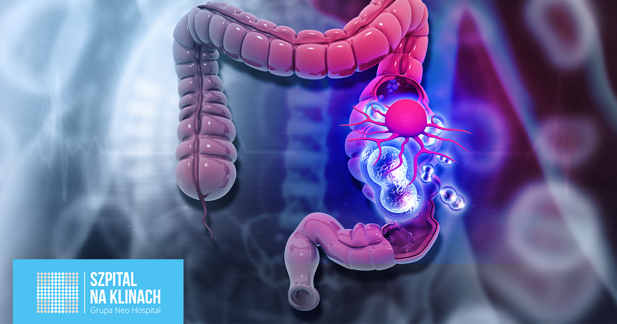 Operacyjne leczenie raka jelita grubego