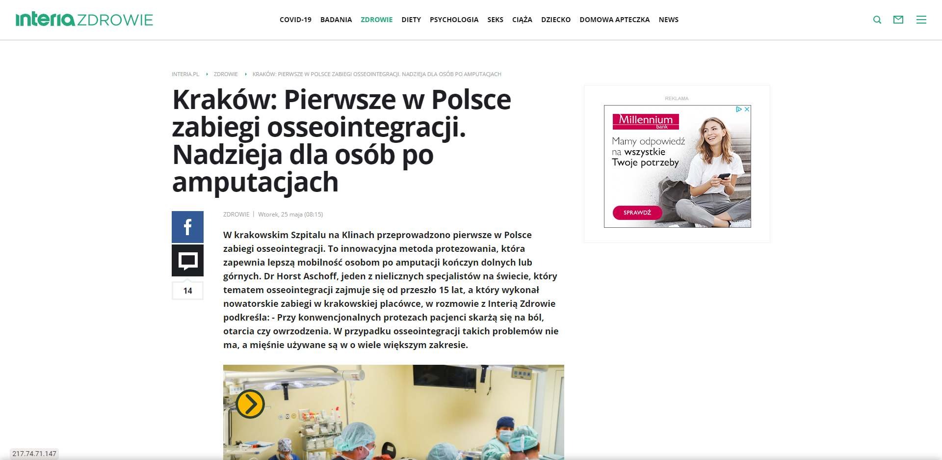 pierwsze w polsce zabiegi osseointegracji nadzieja dla osob po amputacjach
