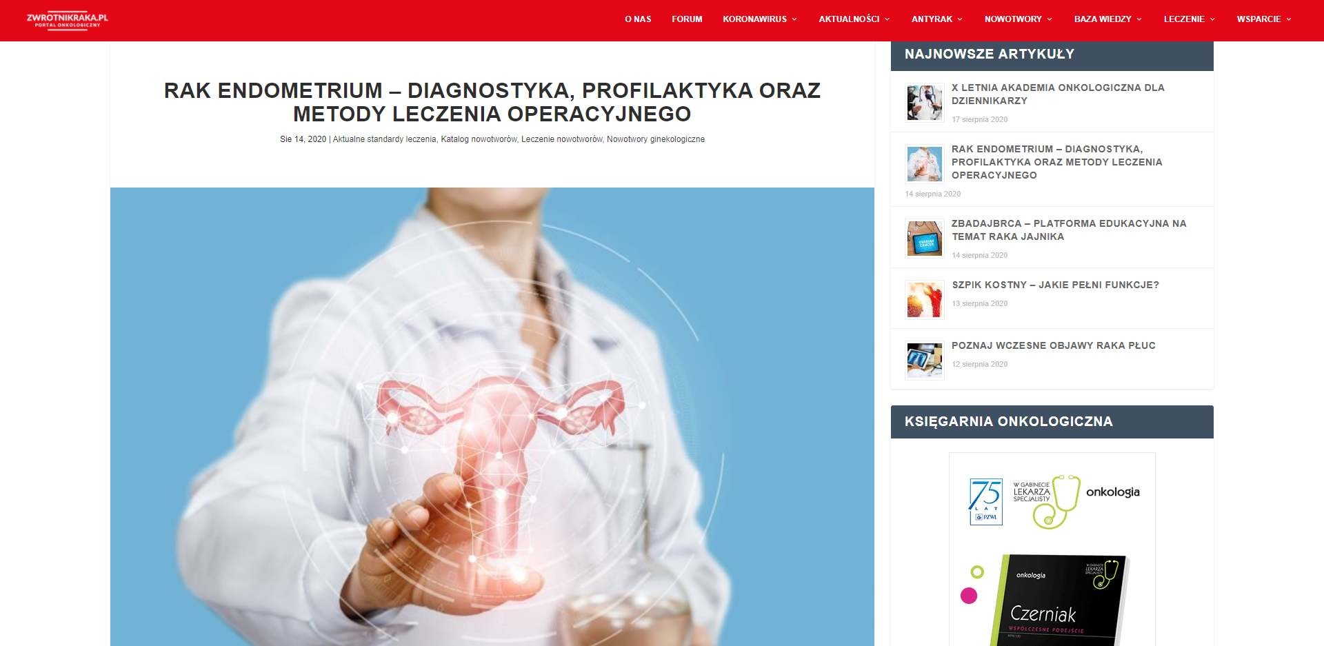 rak endometrium diagnostyka profilaktyka oraz metody leczenia operacyjnego