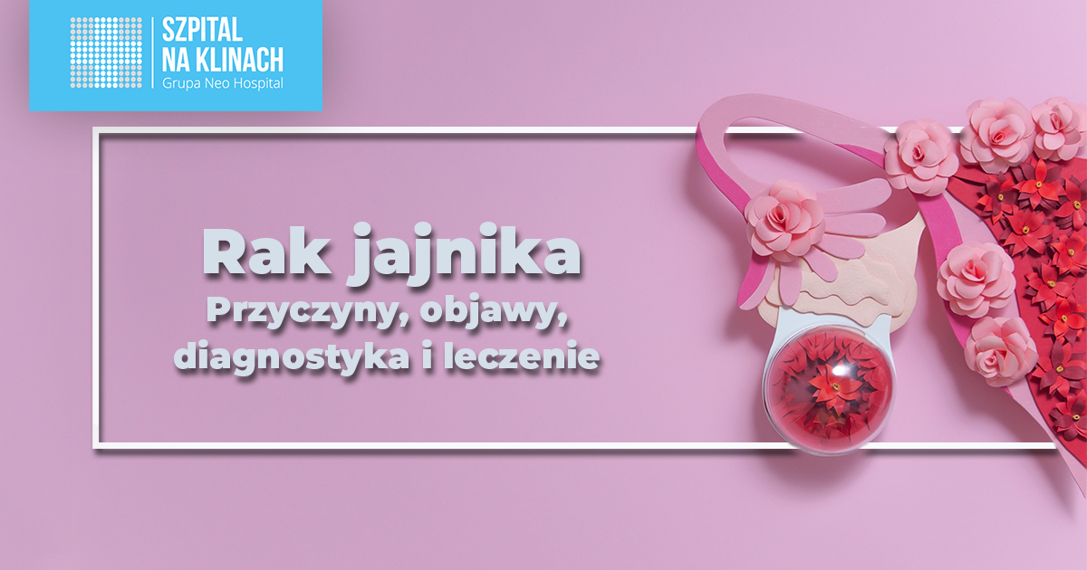 Rak jajnika – przyczyny, objawy, diagnostyka i leczenie