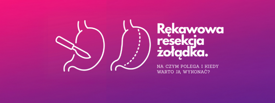 Rękawowa resekcja żołądka. Na czym polega i kiedy warto ją wykonać? rekawowa resekcja zoladka na czym polega i kiedy warto ja wykonac