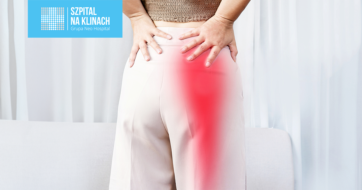 Rwa kulszowa (tzw. korzonki): przyczyny, symptomy i terapia