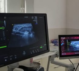 szpital na klinach w czolowce polskich osrodkow specjalizujacych sie w leczeniu lagodnych guzkow tarczycy z wykorzystaniem echolasera