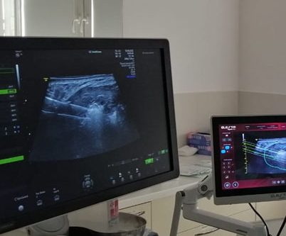 szpital na klinach w czolowce polskich osrodkow specjalizujacych sie w leczeniu lagodnych guzkow tarczycy z wykorzystaniem echolasera