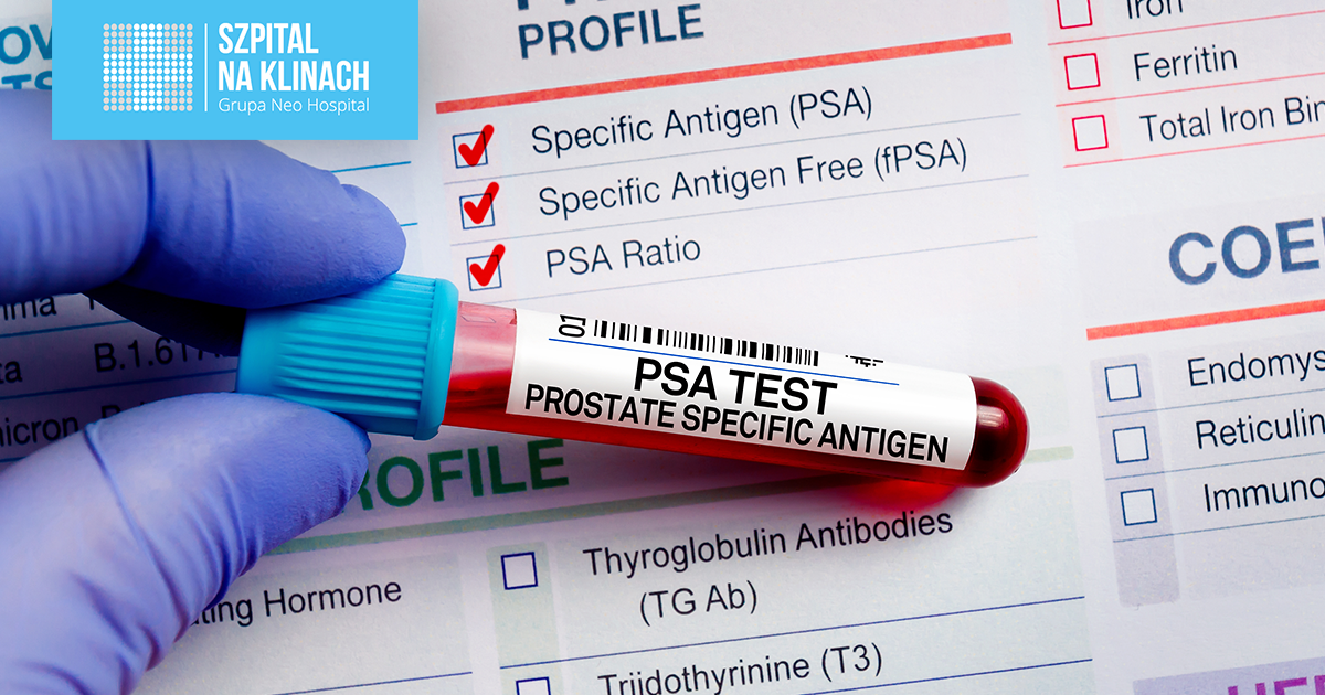 Test PSA – proste badanie, wielkie znaczenie. Co powinieneś wiedzieć o kluczowym badaniu w diagnostyce schorzeń prostaty?