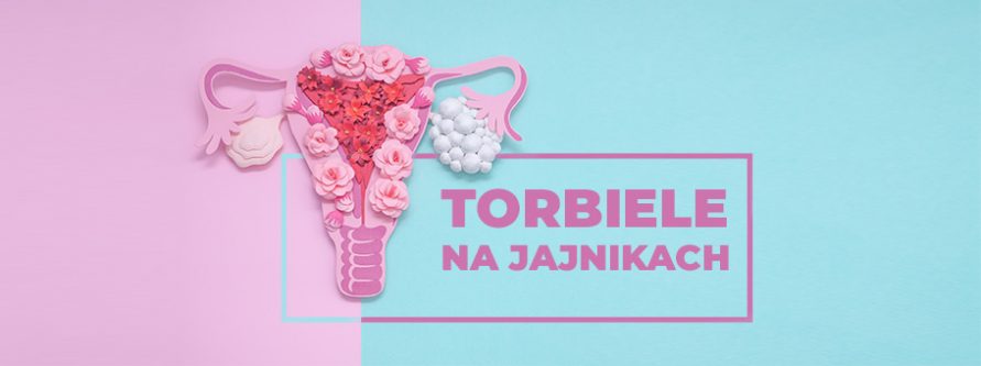 torbiele na jajnikach