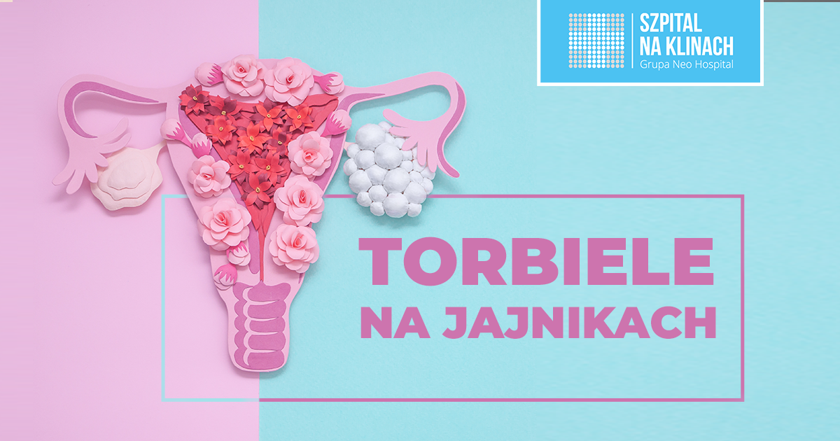 Torbiele na jajnikach – czym są, dlaczego powstają, jakie dają objawy i jak się je leczy?
